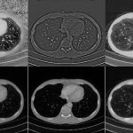 Enhancement of CT Images for Visualization