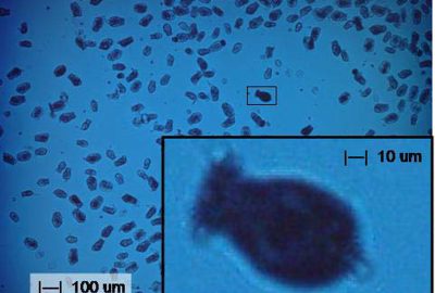 2007 ETech Zimmerman: Lensless Stereo Microscopic Imaging