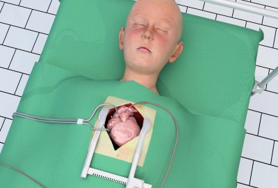 2006 ETech Sørensen: Virtual Open Heart Surgery - Training Complex Surgical Procedures in Congenital Heart Disease