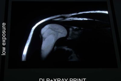 2008 ETech Bimber: Superimposing Dynamic Range