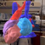 Hands-Free Augmented Reality for Vascular Interventions