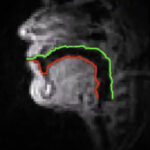 Silent Speech and Emotion Recognition from Vocal Tract Shape Dynamics in Real-Time MRI