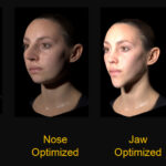 Cosmetic-Vis: Sample-based 3D Facial Editor for Cosmetic Medical Visualization