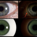 Plausible Iris Caustics and Limbal Arc Rendering