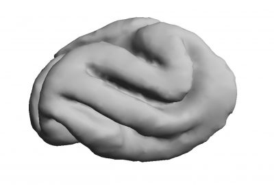 2015 Posters: Holloway_Contour Guided Surface Deformation For Volumetric Segmentation