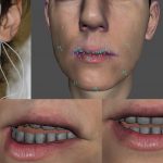 Dynamic Realistic Lip Animation using a Limited number of Control Points