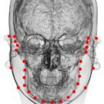 Facial Fattening and Slimming Simulation Considering Skull Structure