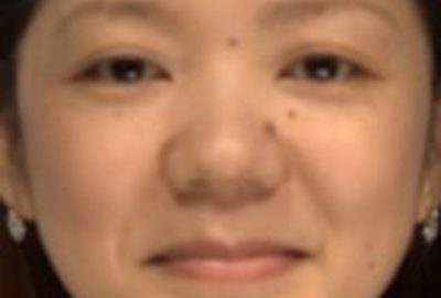 2014 Poster: Fujisaki_Facial Fattening and Slimming Simulation Considering Skull Structure