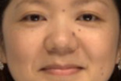 2014 Poster: Fujisaki_Facial Fattening and Slimming Simulation Considering Skull Structure