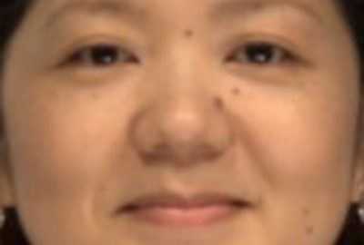 2014 Poster: Fujisaki_Facial Fattening and Slimming Simulation Considering Skull Structure