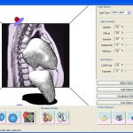 MIBlob: A Tool for Medical Visualization and Modelling using Sketches