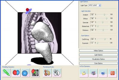 2004 Poster: Araujo_MIBlob: A Tool for Medical Visualization and Modelling using Sketches