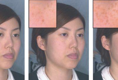 2005 Talks: Tsumura_Real-time image-based control of skin melanin texture