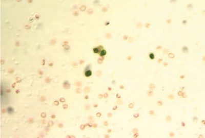 2013 Poster: Wang_Unsupervised Cell Identification on Multidimensional X-Ray Fluorescence Datasets