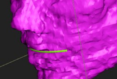 2013 Poster: Olsson_SplineGrip - An Eight Degrees-of Freedom Flexible Haptic Sculpting Tool