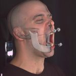 Accurate markerless jaw tracking for facial performance capture