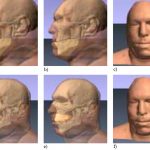 Simulating facial surgery using finite element models