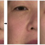 Image-based skin color and texture analysis/synthesis by extracting hemoglobin and melanin information in the skin