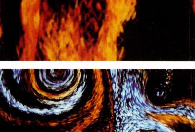 1990 Technical Paper: Sims_Particle Animation and RenderingUsing Data Parallel Computation