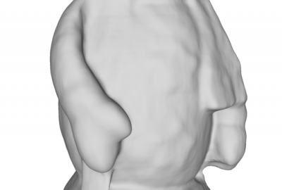 2011 Poster Cui 3D Shape Scanning with a Kinect 03