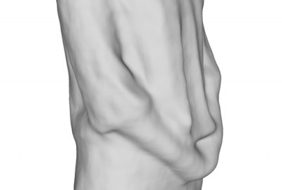 2011 Poster Cui 3D Shape Scanning with a Kinect 05