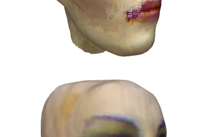 2011 Poster Cui 3D Shape Scanning with a Kinect 09
