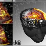 Real-time 4D ultrasound visualization with the Voreen framework