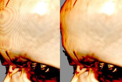 2012 Posters: Gavrilov_Advanced GPU-based Ray Casting for Bricked Datasets