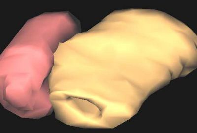 2005 Poster: Kuroda Design and Implementation of MVL: Medical VR Simulation Library