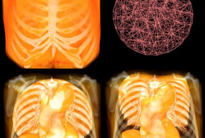 2005 Poster: Nakao Volume Interaction with Voxels by Manipulating 3D General Grids