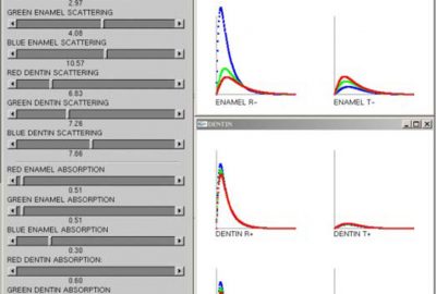 2010 Poster: Shetty A Physical Rendering Model for Human Teeth