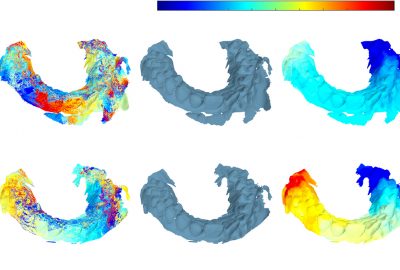 2020 Poster: Huang_Uncertainty quantification for multi-scan registration