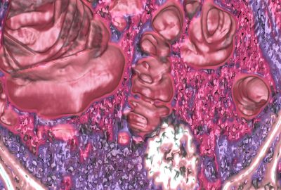 2003 Talks: Hardenbergh_Emissive Clipping Planes for Volume Rendering