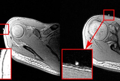 2003 Talks: Iwasawa_How to Capture Absolute Human Skeletal Posture