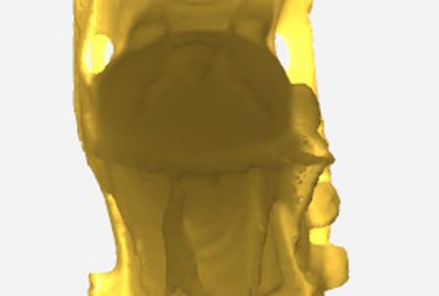 2006 Poster: Banterle A Dual Funnel Approximation for the Appearance of Translucent Material