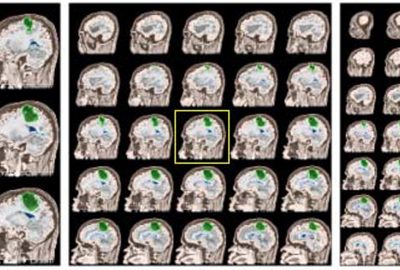 2006 Poster: Gering Integrated Image Zoom and Montage