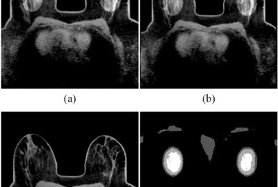 2010 Talks: Bernal_Multigrid Optical Flow for Deformable Medical Volume Registration