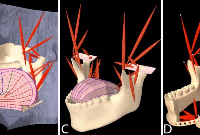 2010 Talks: Stavness_Dynamic Hard-Soft Tissue Models for Orofacial Biomechanics