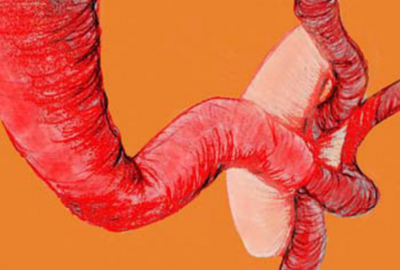 2007 Poster Fyfe 3D Computer Graphics and Diabetes Disease Understanding 01