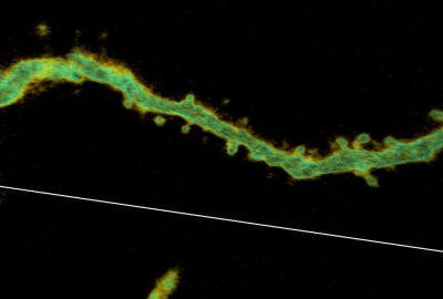 2007 Posters: Liang Bridging the Resolution Gap: Superimposition of Multiple Multi Channel Volumes