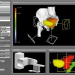 Application of computer graphics for design and delivery of conformal radiation therapy