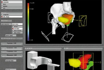 1999 Talks: Kessler_Application of Computer Graphics for Design and Delivery of Conformal Radiation Therapy