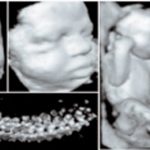 Variational Classification for Visualization of 3D Ultrasound Data