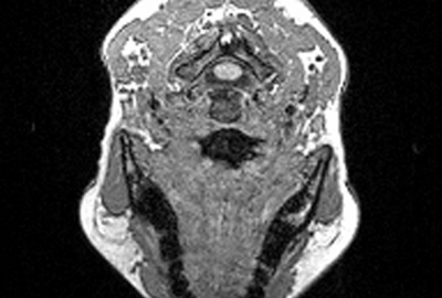 2009 Posters Yarimizu Muscle based Facial Animation Considering Fat Layer Structure Captured by MRI 03