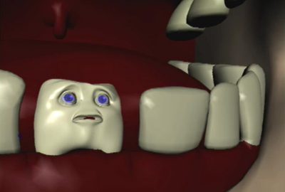 2007 Fjorg: Henchmen_Loose Tooth