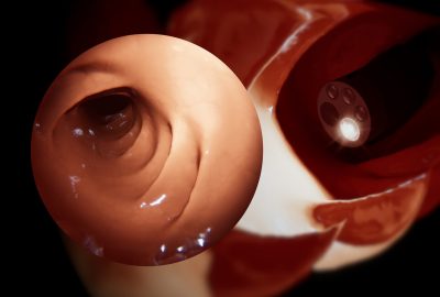 2024 Technical Papers: Martins_Efficient Position-based Deformable Colon Modeling for Endoscopic Procedures Simulation