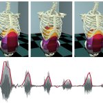 2008 SA Technical Paper: DiLorenzo_Laughing Out Loud