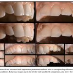 2018 SA Technical Papers_Velinov_Appearance capture and modeling of human teeth