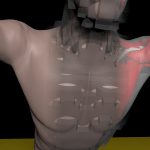 2012 SA Technical Papers_Patterson_Simulation of Complex Nonlinear Elastic Bodies using Lattice Deformers