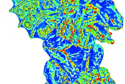 2014 SA Technical Papers Xiong_Robust Surface Reconstruction via Dictionary Learning